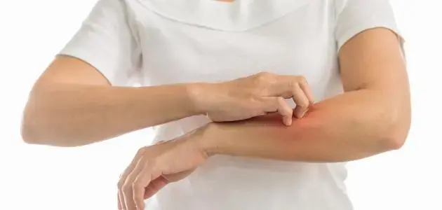 Does Vitamin D Deficiency Cause Itchy Skin?