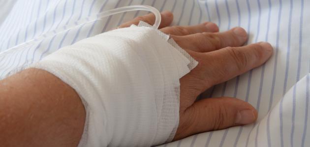Symptoms and Treatment of Sodium Deficiency
