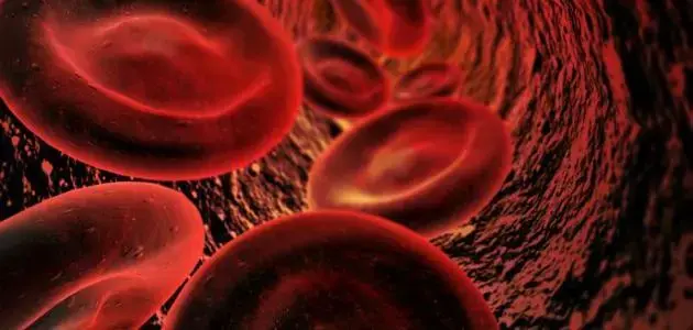 Hyponatremia: Understanding Sodium Deficiency in the Blood