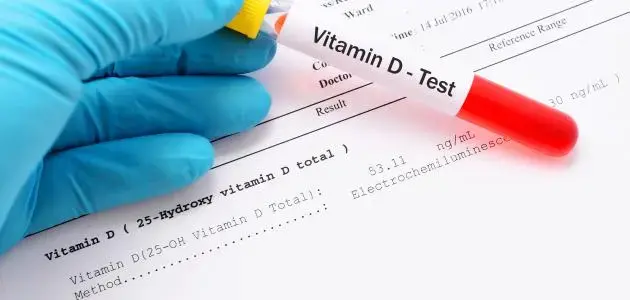 Vitamin D Deficiency and Its Link to Obesity